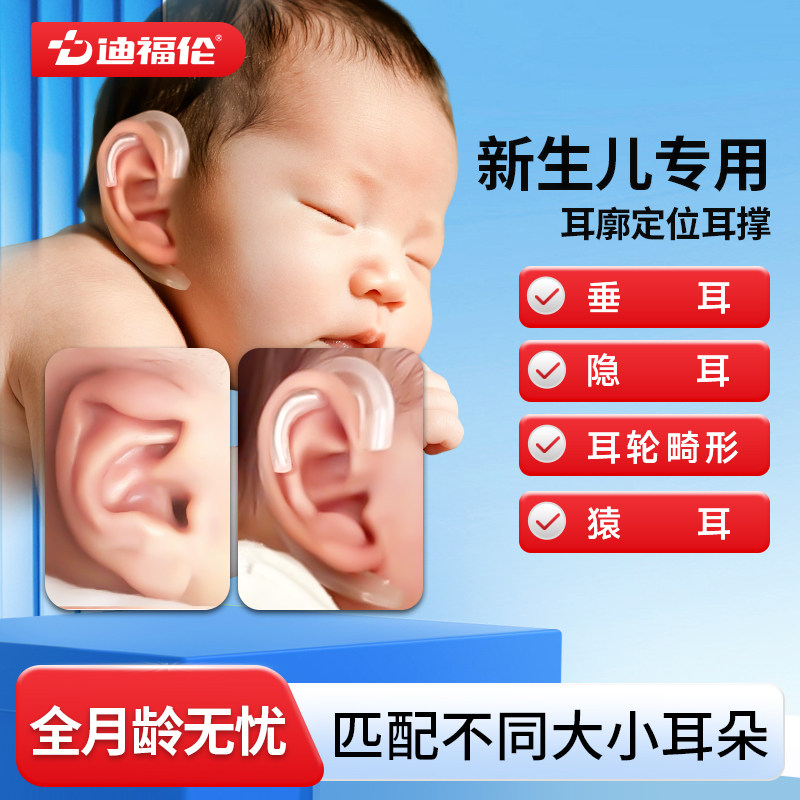 迪福伦新生儿耳廓定型耳撑图片
