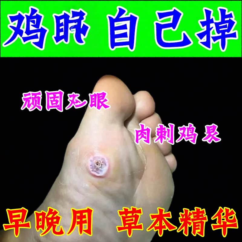 脚上肉刺膏贴脚贴顽固老茧贴硬肿白厚茧子修护贴