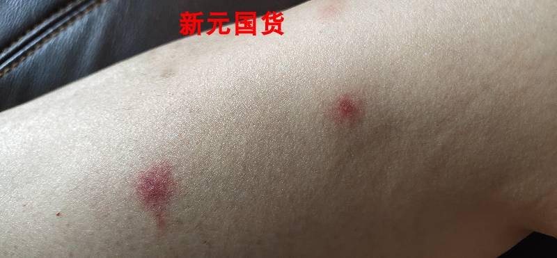 体癣牛皮癣宝宝好抑菌药膏舒立嘉草本软膏婴儿湿痒膏