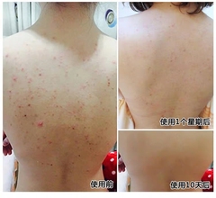 可可籽脂海盐皂除螨皂面部女男杀菌脸部全身正品硫磺去螨虫洗脸皂