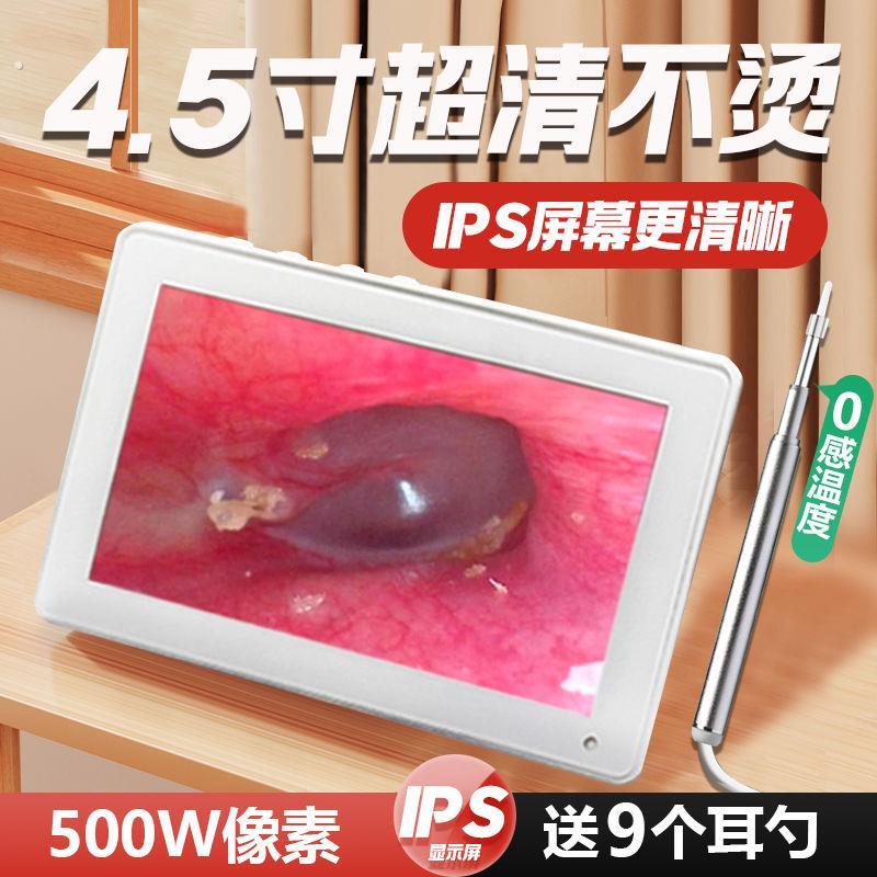 高清可视掏耳神器专业耳鼻喉内视镜 不发烫耳镜采耳仪 7寸大屏送