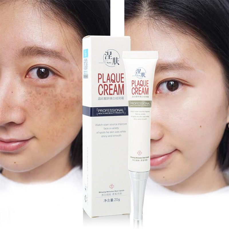 复方sod熊果苷乳膏维e淡斑神器祛斑霜雀斑黄褐斑官方旗舰店正品去