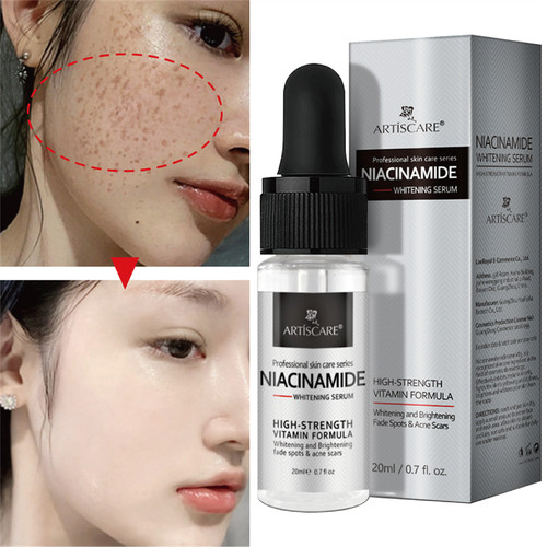 Effective Whitening Serum Remove Dark Spots Freckle Essence