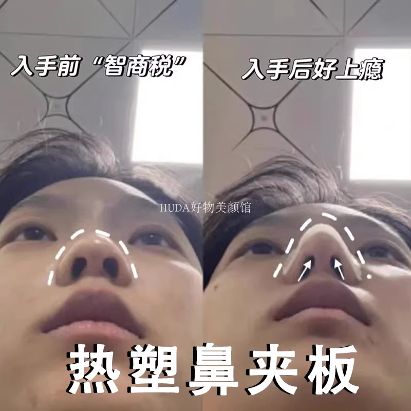 热塑鼻夹板术后鼻子固定器自捏塑形鼻翼缩小矫正器可重复使用