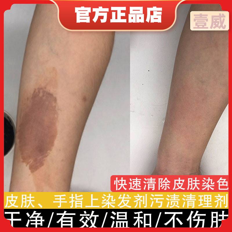 一擦净去除染发剂专用清洗剂去除剂洗掉染发膏的污渍染发药水残留