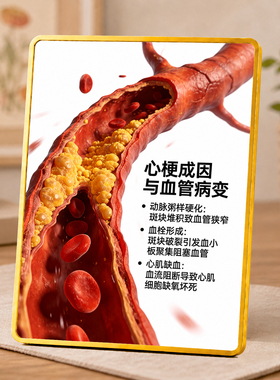 心梗成因与血管病变科普摆台养生馆诊所桌面健康知识装饰摆件