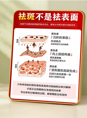 美容院祛斑原理科普展示牌美业门店前台轻奢金边装饰摆件