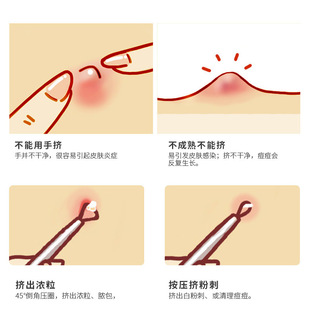 双头黑色棉签掏耳朵耳屎专用挖耳勺棉签大人棉花棒家用耳用