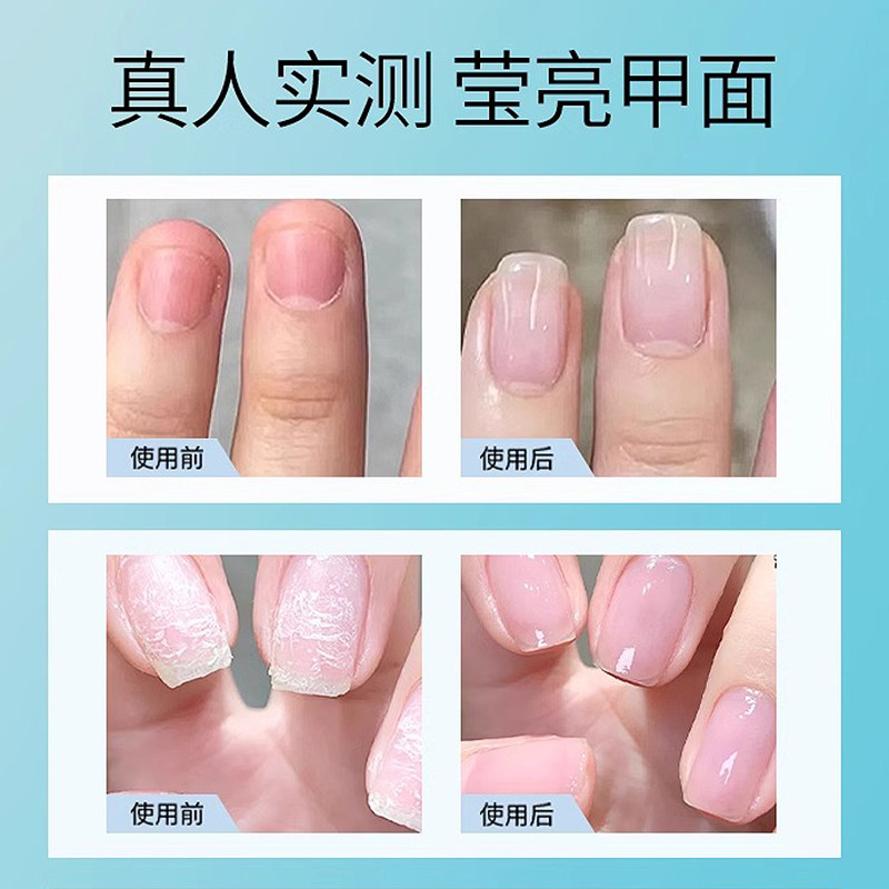 指甲油护甲油营养液透色指缘防断裂滋养非修复液防倒刺美甲店正品