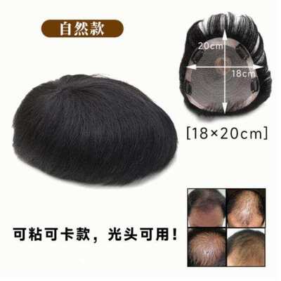 头顶假发片隐形男短发无痕轻薄前额寸真补发男士片全假发发毛男生