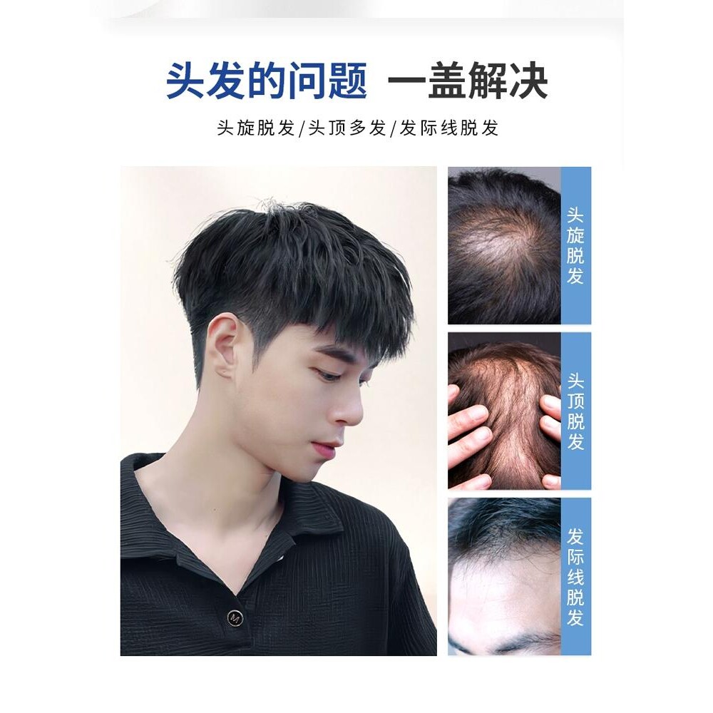 短发造型全手织男士假发真发黑色假头发头顶补发块自然男式假发片图片