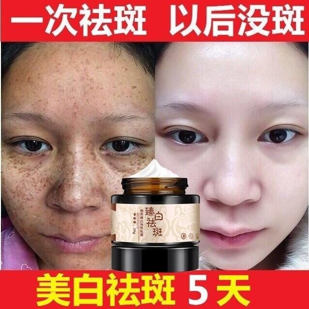 祛斑霜正品去雀斑祛老年斑去黑斑男女脸部手部怯斑霜。