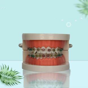 后牙嘴巴扩张器开口扩嘴器牙科口腔阔口扩牙撑嘴口撑括口非一次性