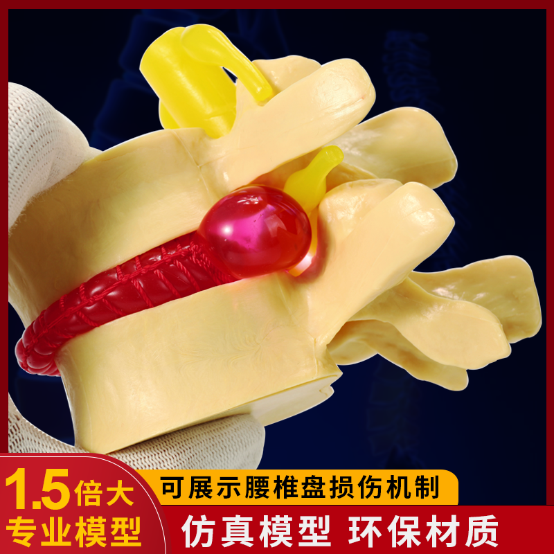 医学放大人体腰椎间盘挤压演示模型脊柱脊椎骨骼病理关节突出教具