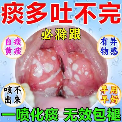 喉咙卡痰嗓子有异物感老有痰不舒服痰多吐不完粘嗓子咽喉化痰喷剂