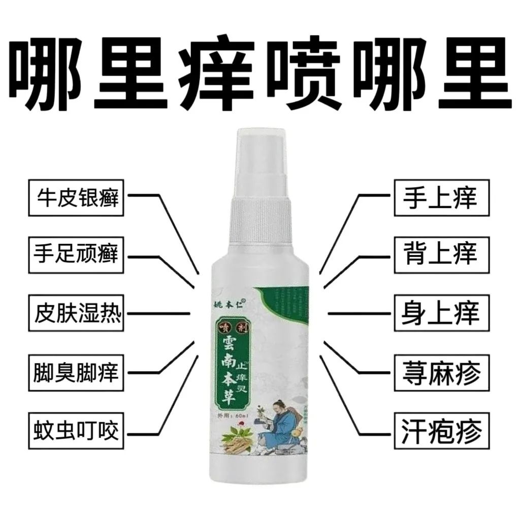 云南止痒银屑病牛皮癣湿疹汗手足藓皮肤干燥瘙痒全身止痒喷剂