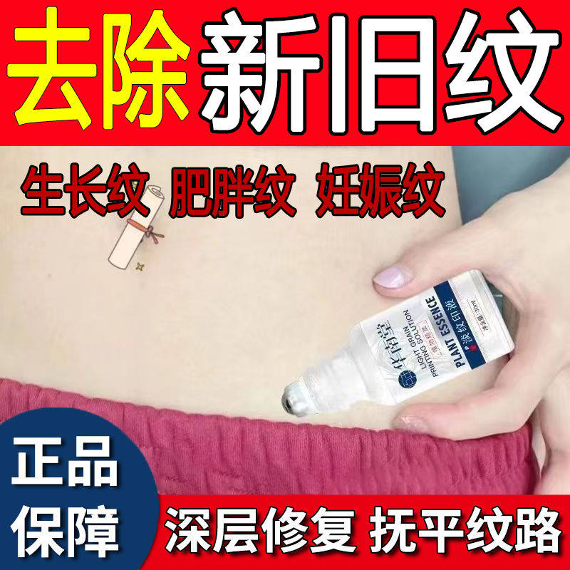去除肥胖纹药膏妊娠纹祛疤消除生长纹专门用遮挡淡化产后紧致修复