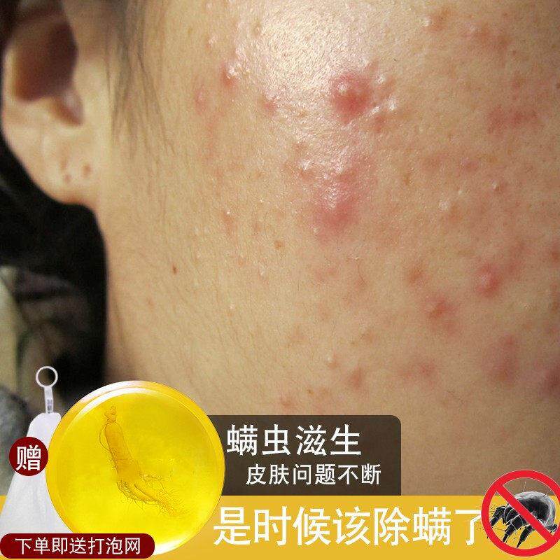 苦参洁面除螨虫香皂洗脸洗澡去螨专用沐浴全身女男人参硫磺皂肥皂