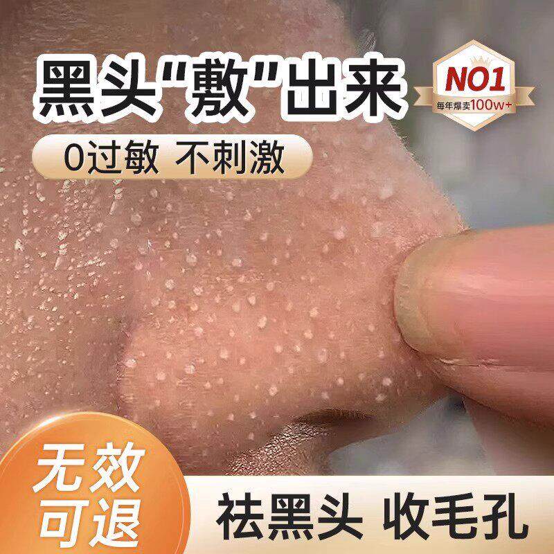 氏推荐!强力去黑头鼻贴青少年去白头粉刺闭口导出液深层清洁