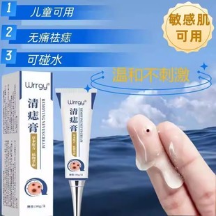 【Wrrgy清痣膏】哪有黑点抹哪里无痕无痛祛痣膏全身可用
