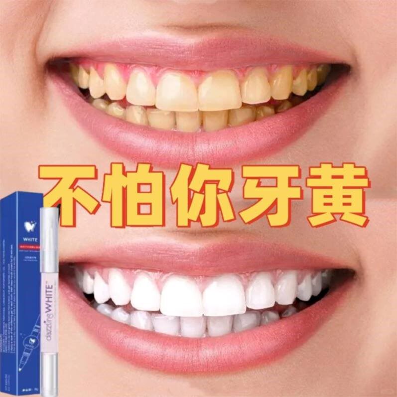 美白牙齿洗牙齿美白去牙渍垢黄牙速效牙白去黄神器牙结黄速效洗白