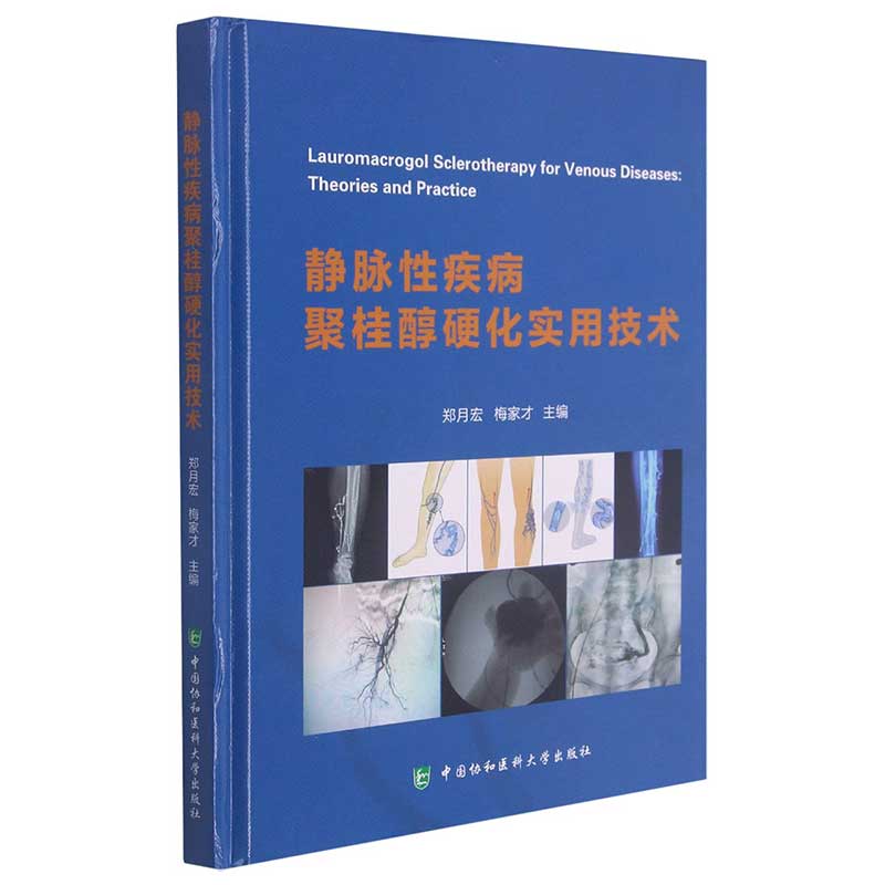 正版图书 静脉疾病聚桂醇硬化实用技术 郑月宏 中国协和医科大学出版社 9787567917606
