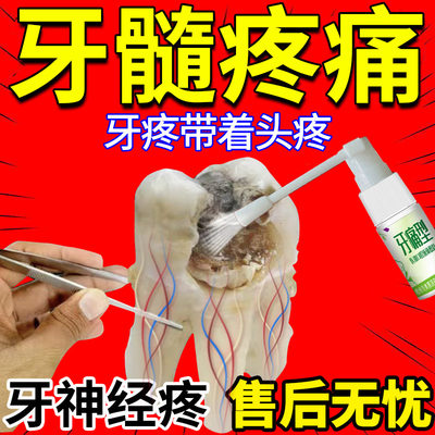 牙髓炎牙神经发炎肿痛牙周炎喷剂