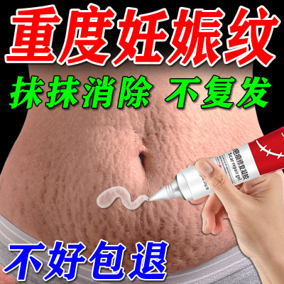妊娠纹产后消除修复疤痕医用凝胶