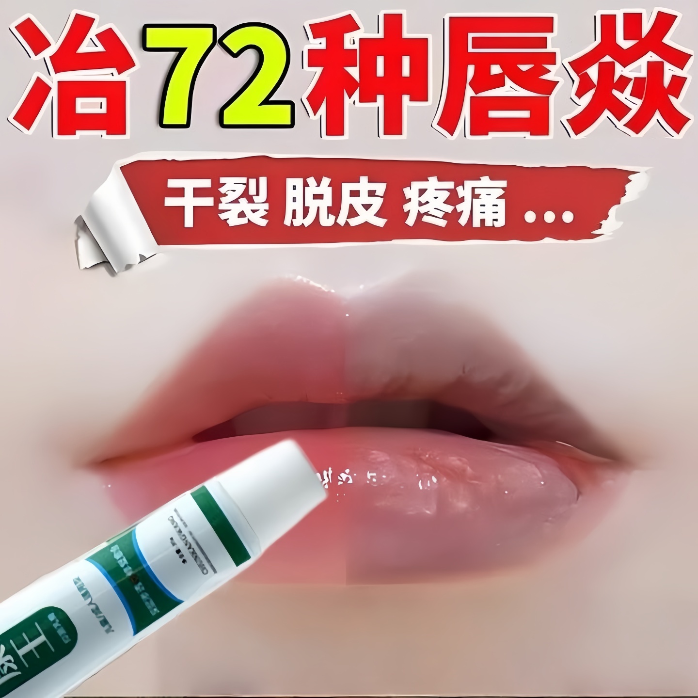 唇（焱专用膏医/用润唇膏修护焱唇口角）炎干裂脱皮修复嘴唇唇膏