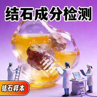 肾结石尿结石成分检测 结石元素种类分析检查