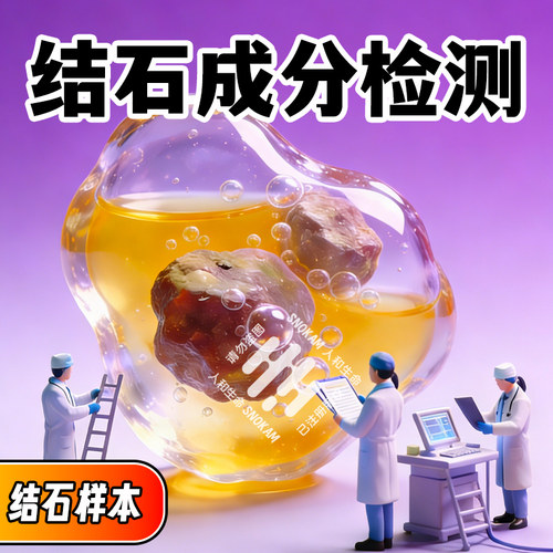 肾结石尿结石成分检测 结石元素种类分析检查