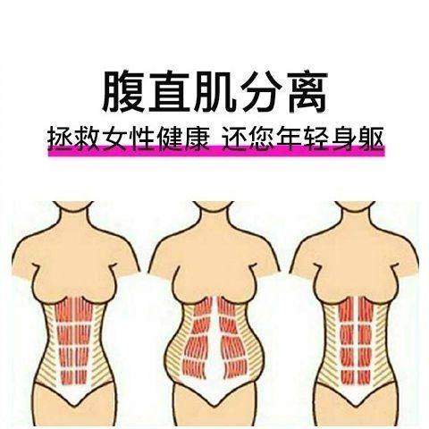 腹直肌分离修复盆底肌仪产后康复训练女性健康个人护理电刺激按摩