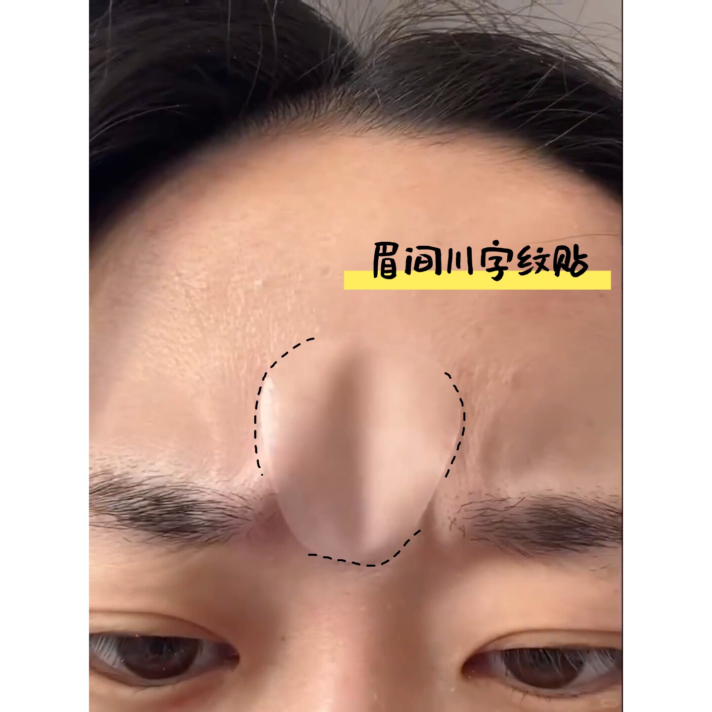 川字纹贴睡觉专用眉间额头贴面部提拉隐形贴紧致抬头纹防皱纹神器
