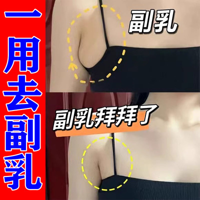 副乳消除贴去副乳腋下淋巴囊肿疏通神器副乳隐形贴收副乳专用贴SZ