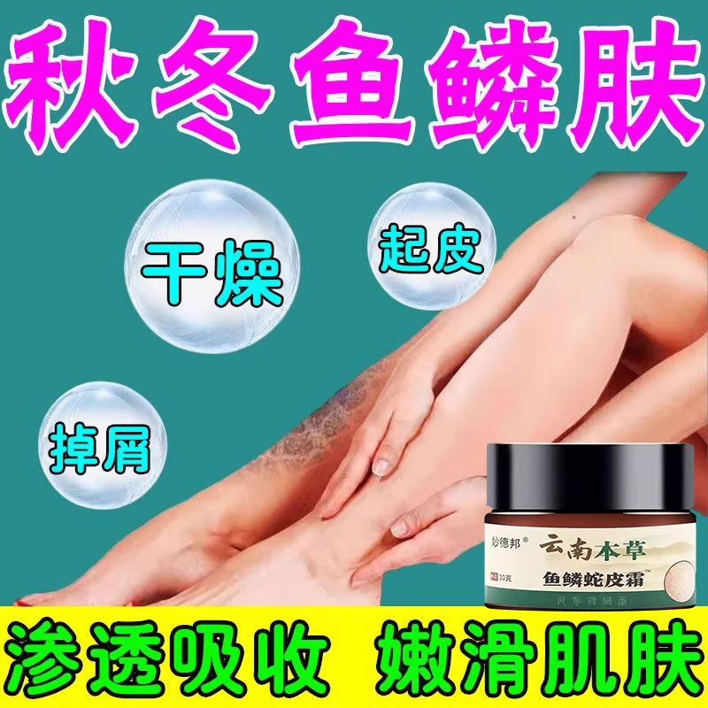 鱼鳞皮肤专用可搭药膏小腿干燥起皮鱼鳞皮肤霜腿部蛇皮腿去除神器,洗护清洁剂/卫生巾/纸/香薰,护手霜,淘宝优惠券,粉丝福利购,淘宝优惠卷