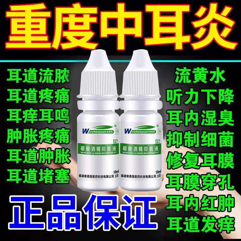 中耳炎神器日本进口专用外耳道红止痒滴耳液菌儿童耳朵痒泰利必妥