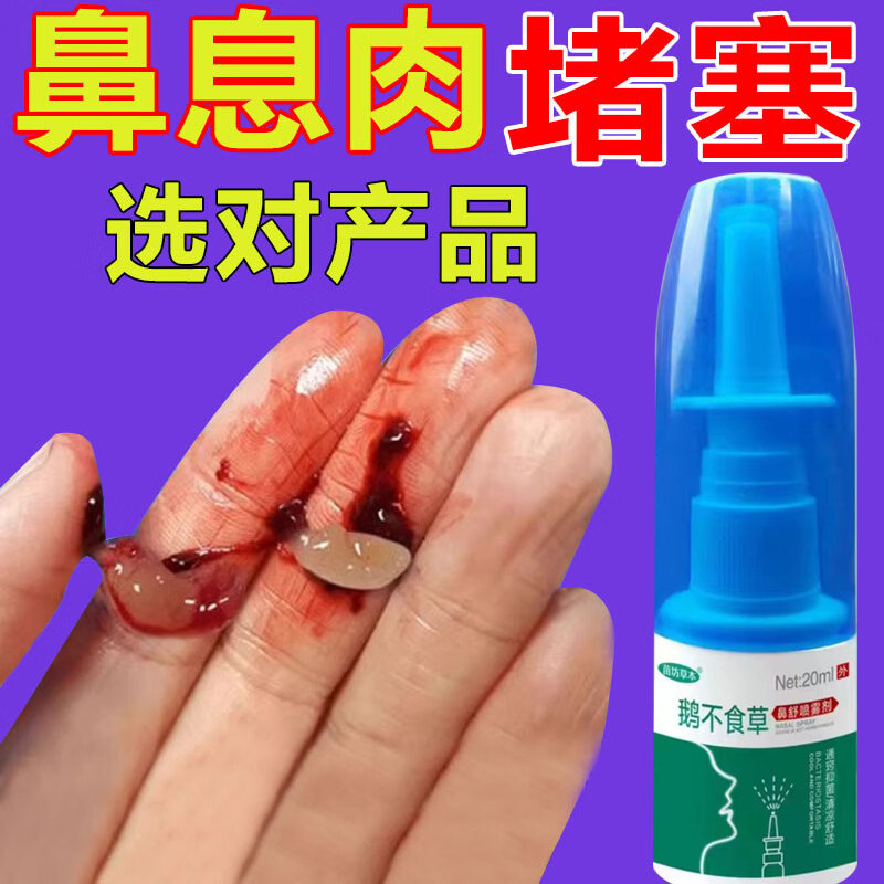 氯雷他定片鼻炎息斯敏他定片片过敏性ZZ葵花腺样体贴张口呼吸夜