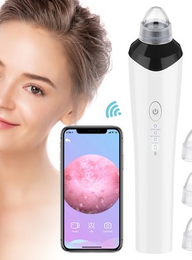 Blackhead Vacuum Visible Black Head Remover Facial Pore Clea