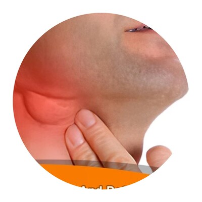 Lymphatic Detox Ointment Neck Anti-Swelling Lymph Cream Herb