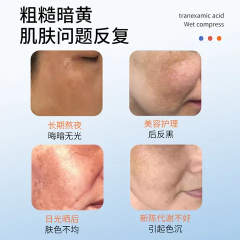 暗沉精华液氨甲环酸ml100提亮iOEO液5％黑色素湿敷传明酸