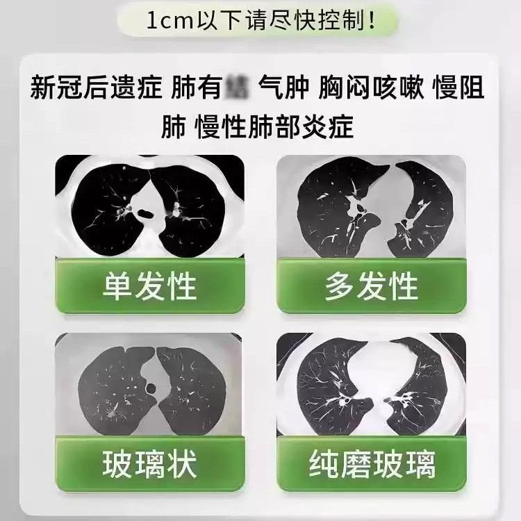 抖音爆款美国夏枯草猫爪草清甲状腺乳腺肺节蒲公英效甘草散片胶囊