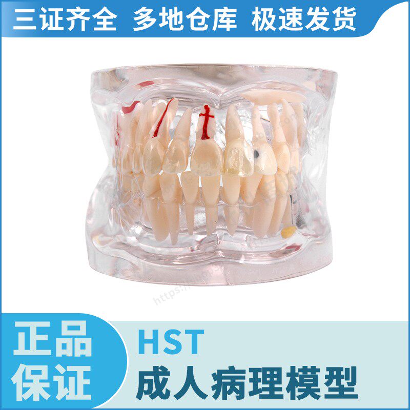 HST 成人病理模型 HST-C4 牙科口腔教学学习