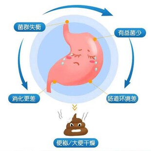 益生菌浓缩片活菌冻干粉调理肠胃道大便干结N成人中老年促进排便