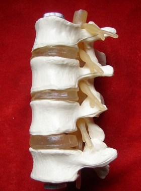 Human Skeleton Model Lumbar Disc Disease Model Spine Model L