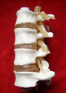 Human Skeleton Model Lumbar Disc Disease Model Spine Model L