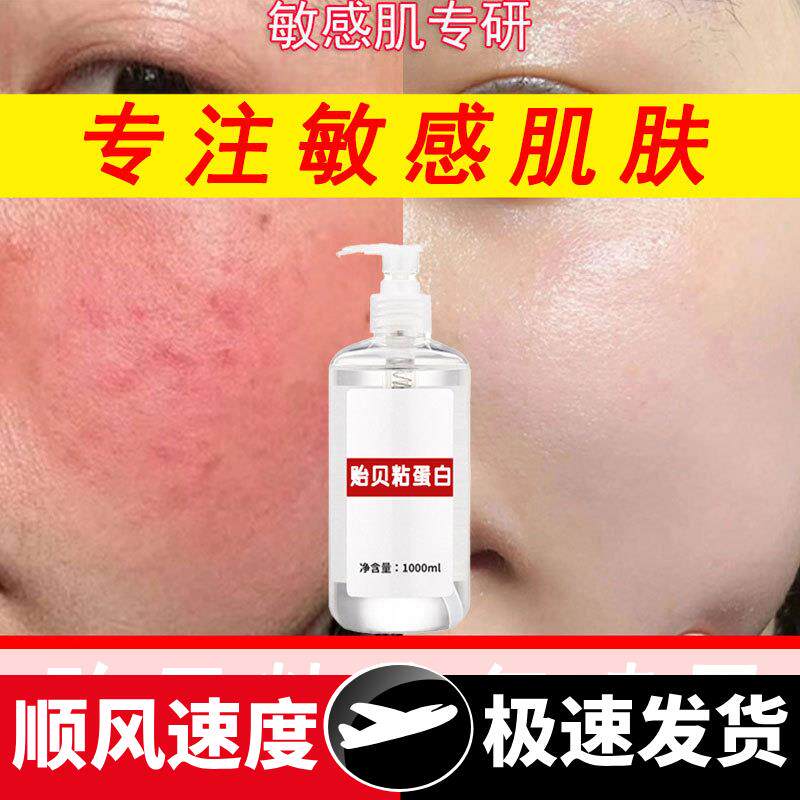 贻贝粘蛋白修复喷雾修护角质层去红血丝敏感肌美容院激素脸精华液