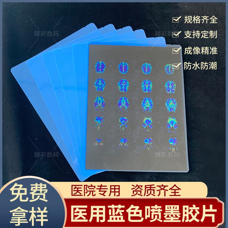 医用喷墨胶片X光CT胶片