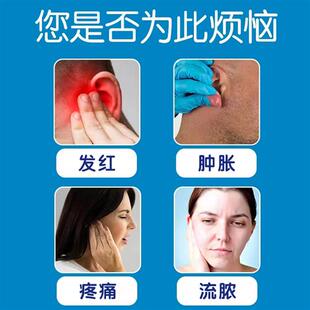 极速耳洞发炎护理液治红肿增生防耳洞发炎消炎液流脓流Z水清洁神
