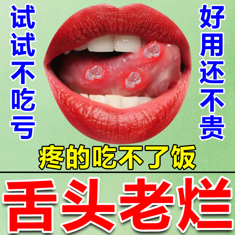 舌头溃疡舌尖疼灼口综合症舌炎