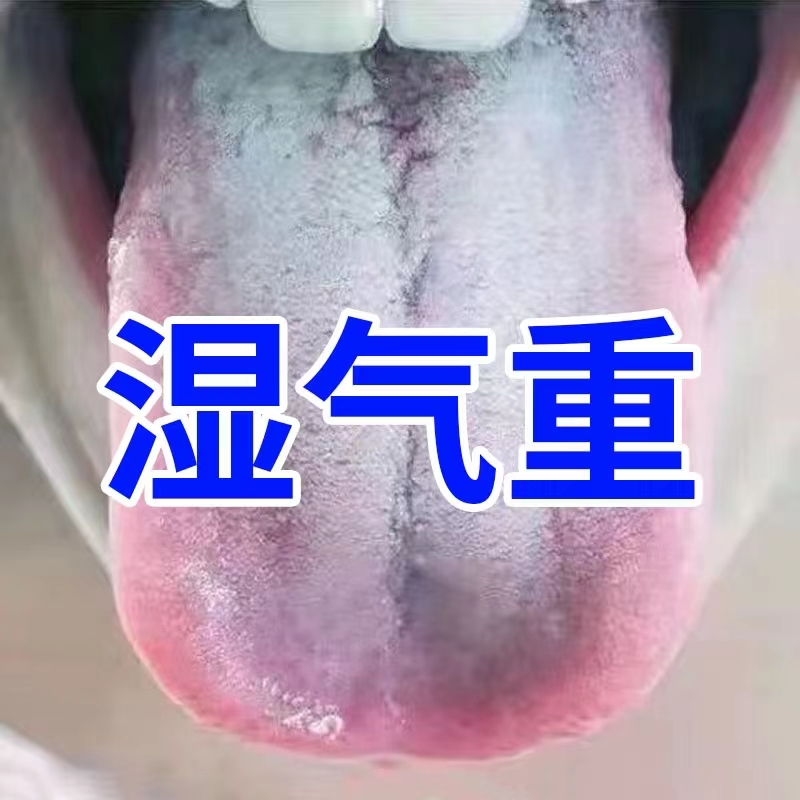 湿气重齿痕舌大舌头舌苔厚有口臭